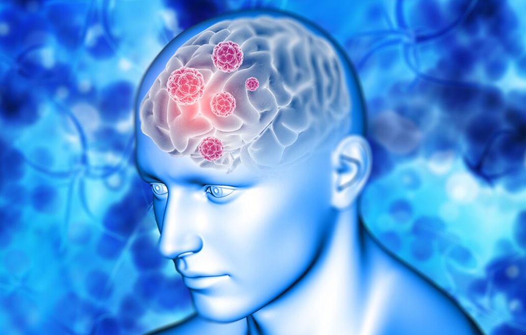 Waspada Dampak Gadget Berlebihan, Fungsi Otak Bisa Menurun Tanpa Disadari